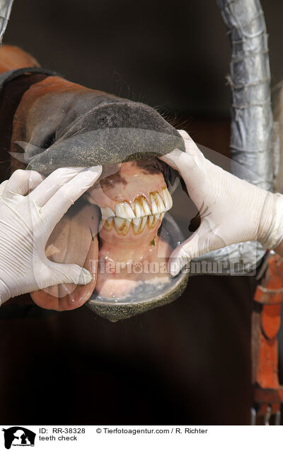 teeth check / RR-38328