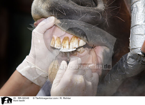Frontzhne abschleifen / front teeth / RR-38346